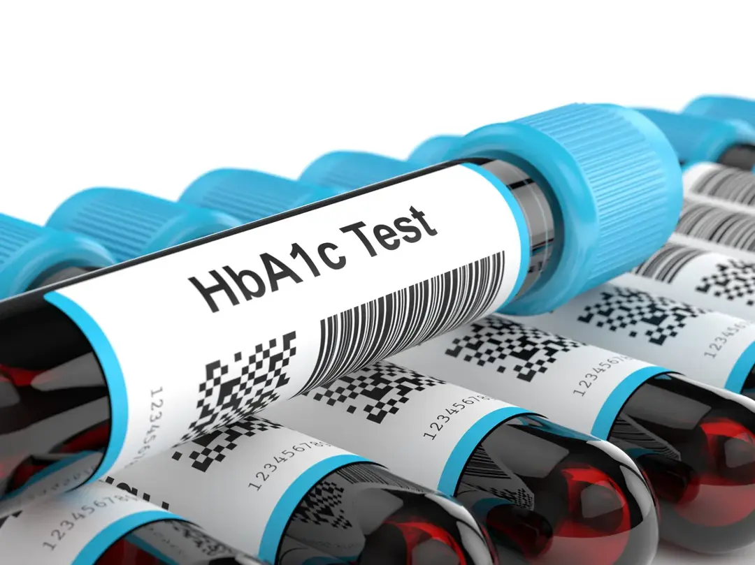 HbA1c blood test vials for diabetes monitoring